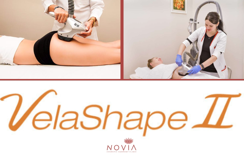 velashape 2