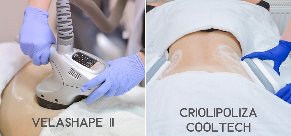 diferente velashape II si criolipoliza