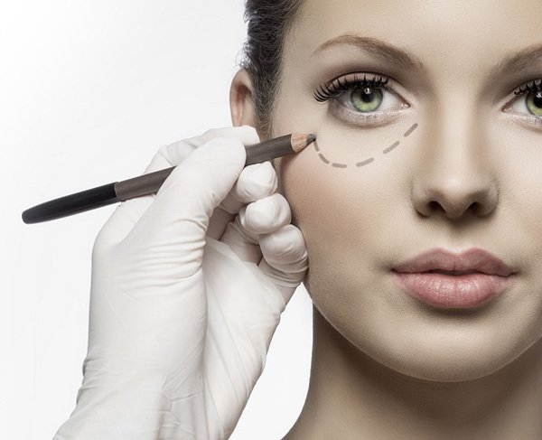 Blefaroplastie