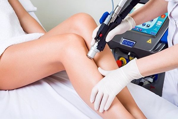 Epilare definitiva Motus AY Cluj